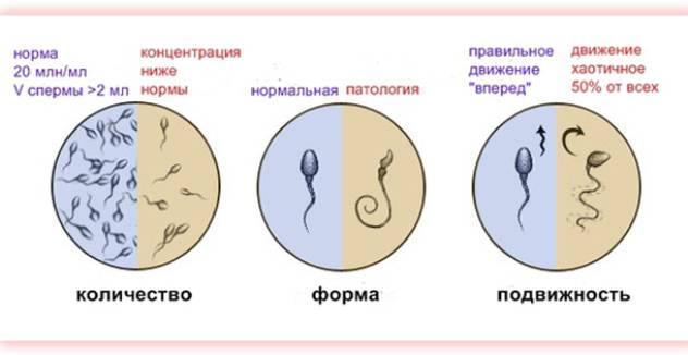 секреторное бесплодие у мужчин